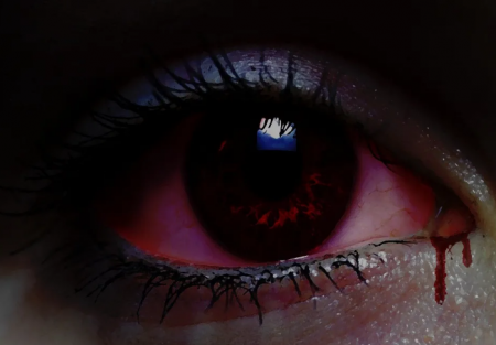تفسير حلم خروج الدم من العين